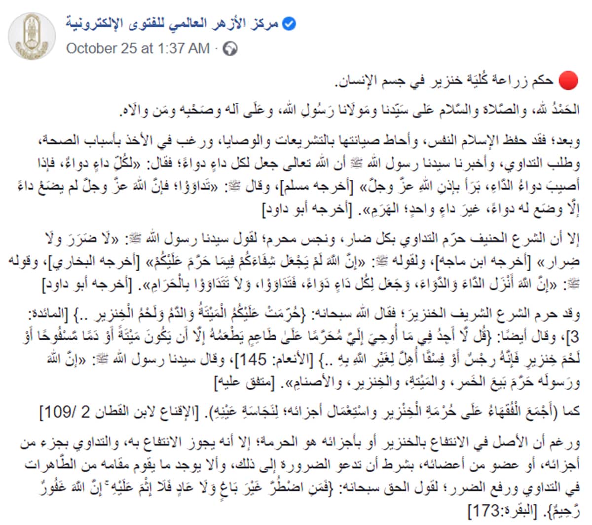 Publicación de Al-Azhar sobre el tema de los trasplantes de órganos provenientes del cerdo (Fuente: Facebook.com/EgyptDarAlifta, 24 de octubre, 2021)