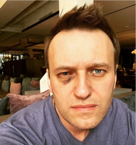 Navalny gets green eye